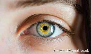 Can an optician can spot if you're at risk of a heart attack? Scan during eye tests could show signs