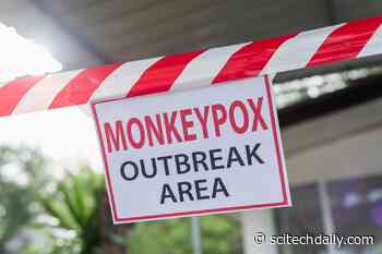 Infectious Disease Expert: What You Should Know About the New Monkeypox Outbreak