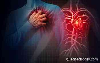 New Treatment Repairs Heart Damage After a Heart Attack With No Side Effects