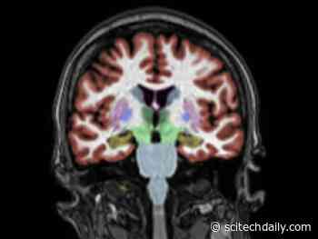 Scientists May Have Found Missing Link Between Alzheimer’s and Vascular Disease