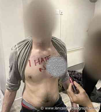Photo shows UCLan student with racial slur and symbol on chest