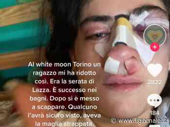 Difende il fidanzato e le rompono il naso: "Aiutatemi a trovarli"