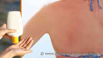 Sonnenbrand adé: Dank Hausmittel-Einsatz den Rücken ohne fremde Hilfe eincremen