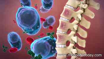 Studies Reinforce Prognostic Role for Circulating Tumor Cells in Myeloma
