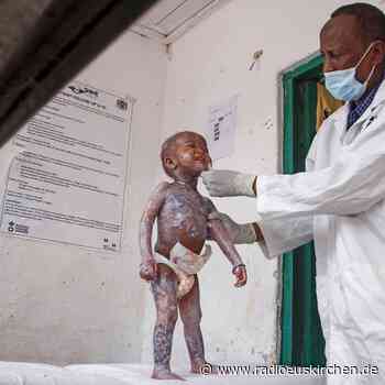 Millionen Menschen von Dürre und Hunger betroffen - radioeuskirchen.de