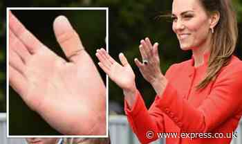 Royal mystery over Kate Middleton's plastered thumb after huge spate of sightings - Express