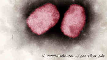 Affenpocken: WHO ruft Notfallausschuss ein – wird die „Notlage“ erklärt?