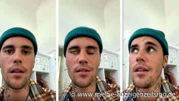 Nach Schock über Justin Biebers Gesichtslähmung: Ursache und Symptome des Ramsay-Hunt-Syndroms