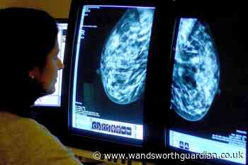 Women with BRCA1 gene could be monitored for breast cancer risk, says study