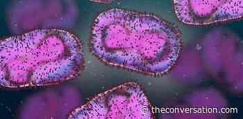 Monkeypox is a DNA virus unlike coronavirus – here's what that means for the virus and us - The Conversation