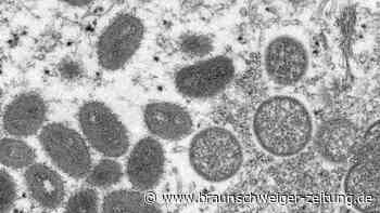 Affenpocken: WHO sieht Europa als Epizentrum der Ausbreitung