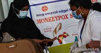 Maritime epidemiologist talks monkeypox, starting with the stigma