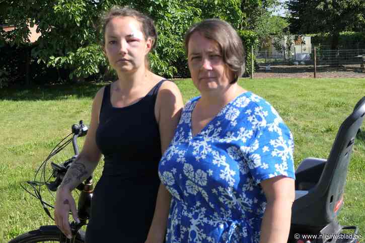 “Waarom rijdt die man gewoon door?”: Lindsey (30) loopt vier breuken op in gezicht na aanrijding door speedbike