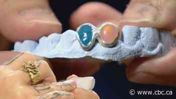 Calgary artist finds niche market with teeth jewelry