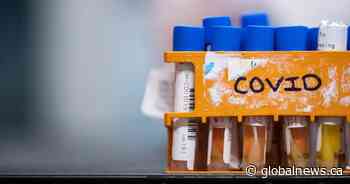 COVID-19: Saskatchewan reports 9 new deaths, 346 new cases, hospitalizations down - Global News