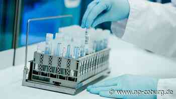 Corona-Pandemie - Städte: Schritte gegen Corona-Sommerwelle nötig - Neue Presse Coburg