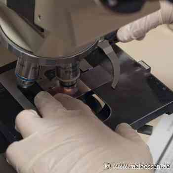 Essen: Zweiter Fall von Affenpocken bestätigt - Radio Essen