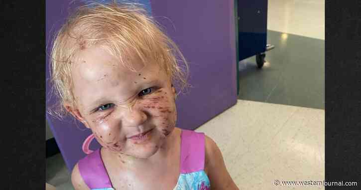 Family's Four Puppies Maul 2-Year-Old Girl while 'Playing,' Eat Half Her Ear