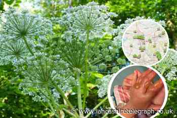 Lancashire's giant hogweed hotspots after child burned by plant