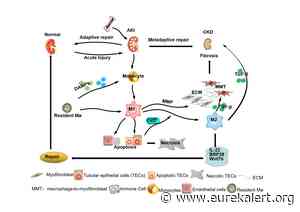 Chinese Medical Journal review explores the role of macrophages in the progression of acute kidney injury to chronic kidney disease - EurekAlert