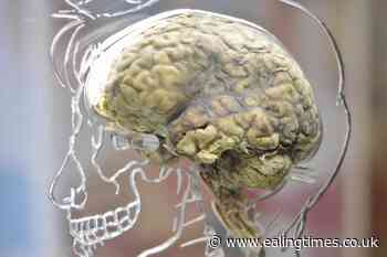 Single brain scan could diagnose Alzheimer's disease, study suggests - Ealing Times