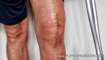 Guideline: Timing Is Everything for RA and Lupus Patients Needing Joint Replacement