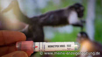 NRW: Gesundheitsamt bestätigt Affenpockenfälle in Dortmund