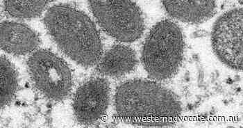 UK to offer monkeypox jab to at-risk men - Western Advocate