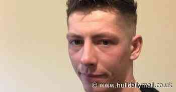 Woman left with hole in her chin after bully's violent attack - Hull Live