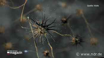 Parkinson-Früherkennung: Uni Kiel entwickelt neue Methode - NDR.de