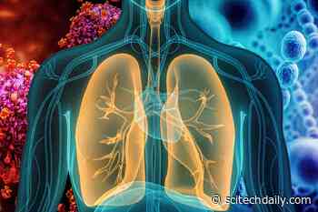 MIT’s New Nanoparticle Sensor Can Distinguish Between Viral and Bacterial Pneumonia