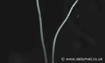 Giant bacteria FIVE THOUSAND times bigger than normal are discovered in a mangrove swamp