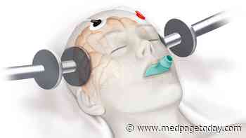 Electroconvulsive Therapy Linked to Manic Episode Response