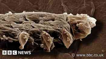 The tiny mites that have sex on our faces have a problem