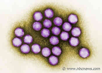 The CDC is still searching for the cause of mysterious liver illness in kids