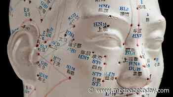 Fewer Headache Days With Acupuncture