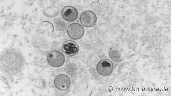 Ist die Verbreitung der Affenpocken noch zu stoppen?