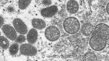 Affenpocken-Ausbruch derzeit keine internationale Notlage
