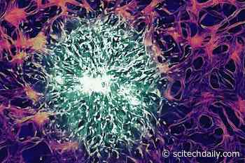 MIT Develops Nanoparticles That Cross the Blood-Brain Barrier To Treat Cancer Tumors