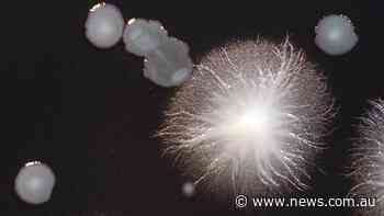 Sixth case of Legionnaires’ in Sydney CBD - news.com.au