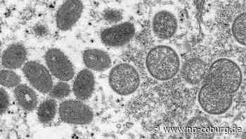 WHO - Affenpocken-Ausbruch derzeit keine internationale Notlage - Neue Presse Coburg