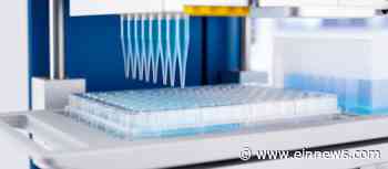 Automated Liquid Handling Systems Market Is Booming Worldwide 2022-2028 | Aurora Biomed, Inc., Hamilton - EIN News