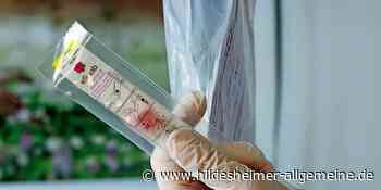 Corona-Inzidenz in Hildesheim etwas höher – bundesweiter Anstieg immer schneller - www.hildesheimer-allgemeine.de