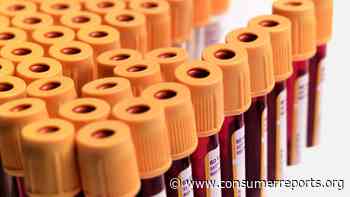 5 Reasons to Get an HIV Test Today - Consumer Reports