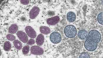 CDC activates Emergency Operations Center for monkeypox