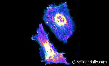 Scientists Seek Innovative Cure for Cancer at the Molecular Level