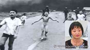‘Napalm Girl' From Iconic Vietnam Photo Receives Burn Treatment in Miami