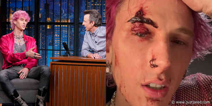 Machine Gun Kelly Explains Why He Smashed a Champagne Flute on His Head