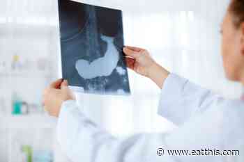 Habits Secretly Increasing Your Pancreatic Cancer Risk, Say Medical Experts — Eat This Not That - Eat This, Not That