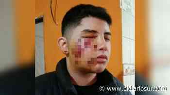 Lomas de Zamora: el Gobierno bonaerense será querellante en la causa del joven que perdió un ojo en un allanamiento - El Diario Sur